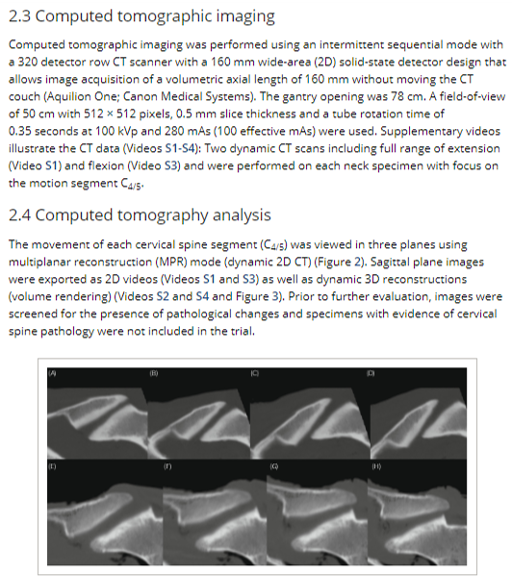 Dynamic three-dimensional computed tomographic imaging facilitates evaluation of the equine cervical articular process joint in motion